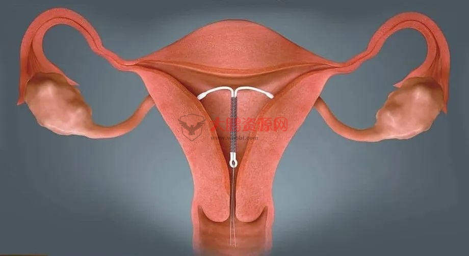 图片[4]-避孕不止安全套，17种避孕方法了解一下好兄弟们-久趣源码交流论坛